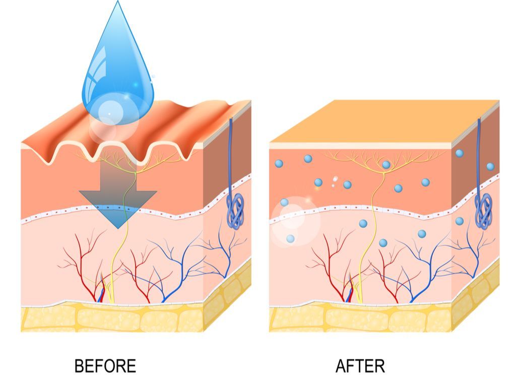 Процедура биоревитализации лица (до и после)